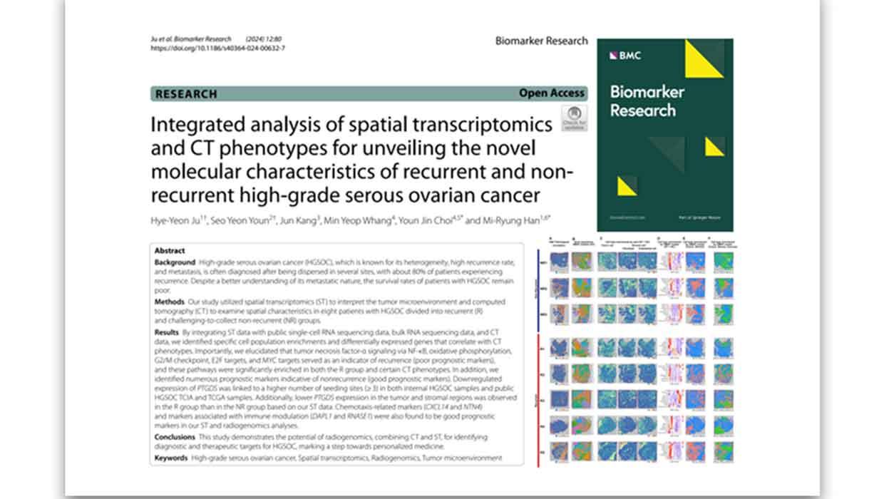 Professor Han Mi-ryeong and Joo Hye-yeon of Incheon National University's Molecular & Medical Science, "High-grade serous ovarian cancer spatial transcription and CT image integrated imaging dielectric" study 대표이미지